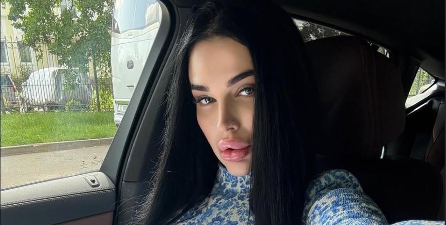 Чому Марія Тиха виглядає як відьма після трьох операцій 1 Чому Марія Тиха виглядає як відьма після трьох операцій 1